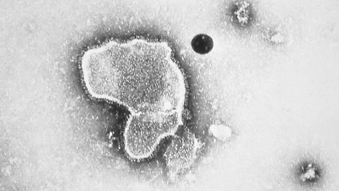 RSV Vaccine development: Pfizer shares promising results | cbs8.com
