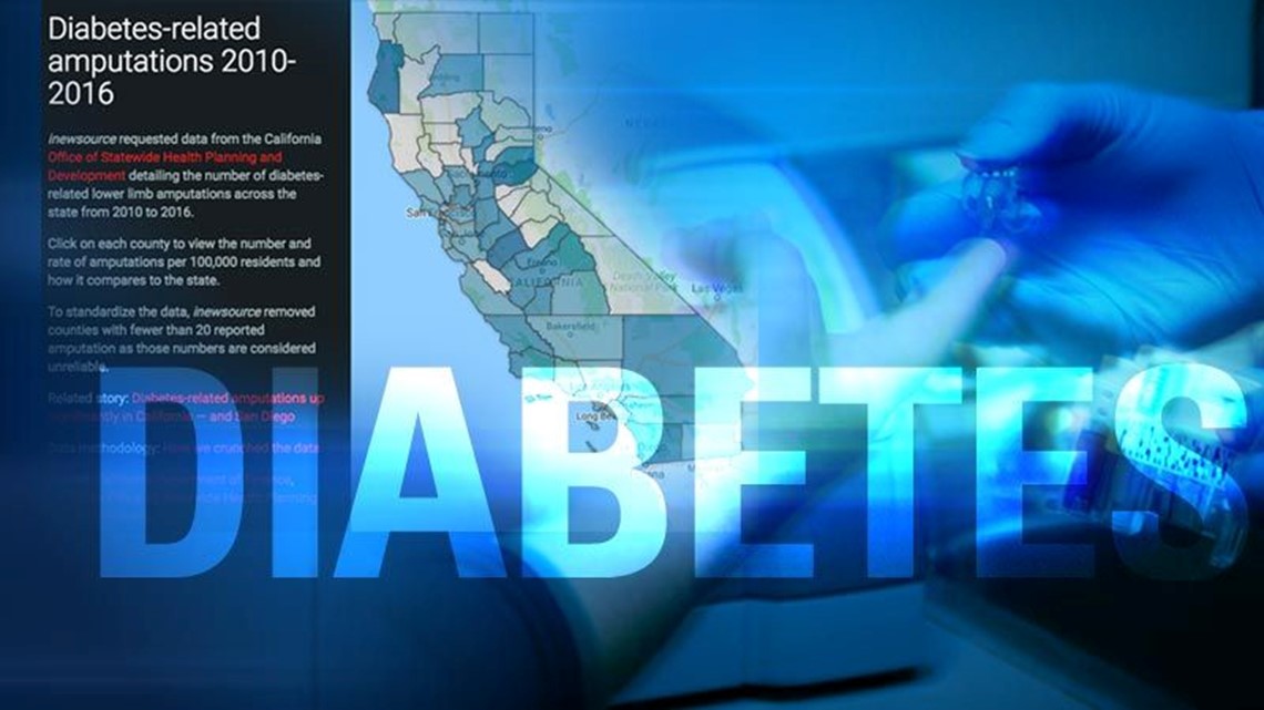 Diabetes-related amputations up significantly in California - and San Diego | cbs8.com