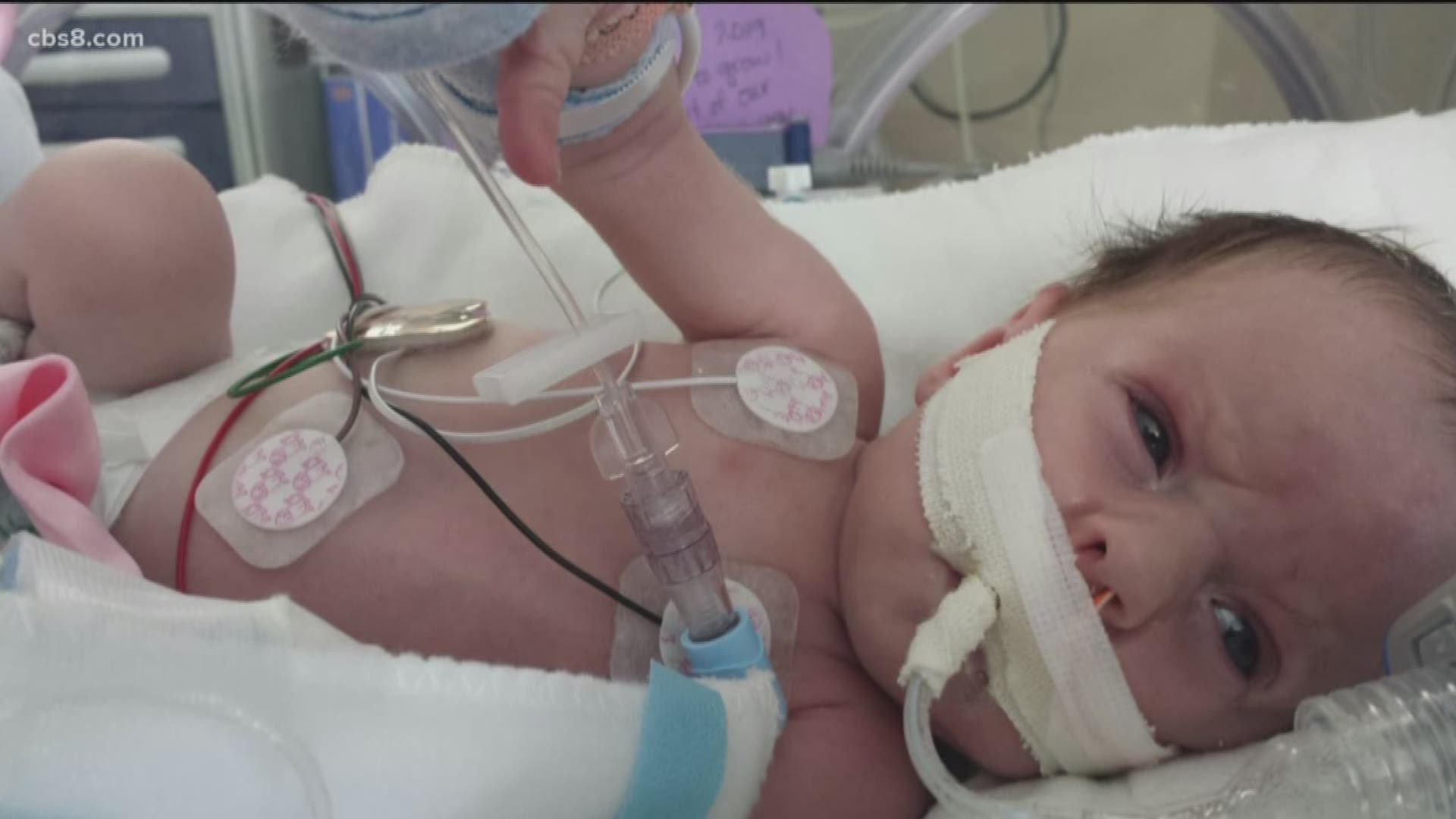 At just three weeks old, doctors at Rady Children’s Hospital performed a heart transplant on Eliana.