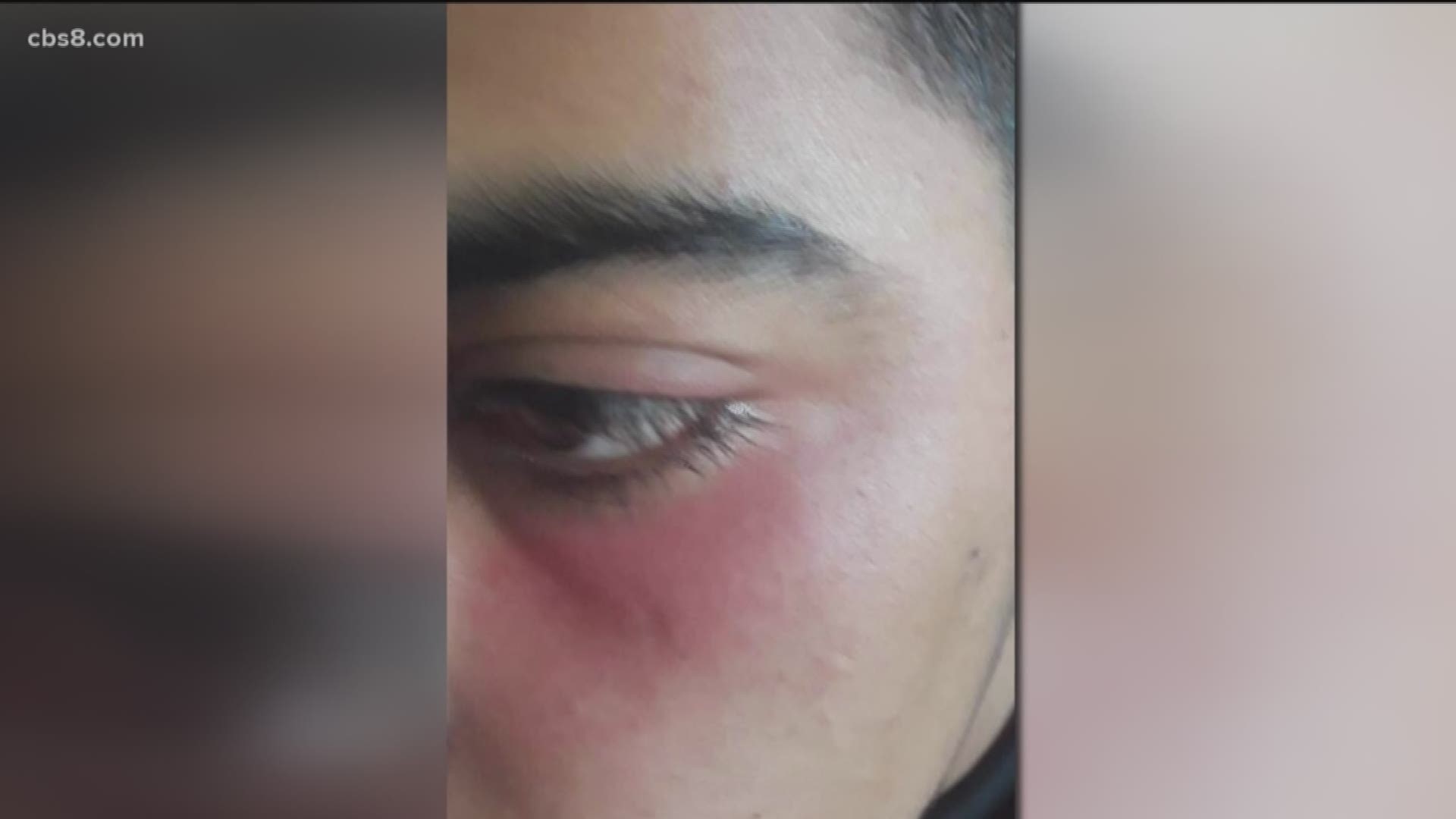 A San Diego Syrian teenager was FaceTiming with a friend when a man allegedly attacked him on the MTS Orange trolley line near Encanto because of his ethnicity.