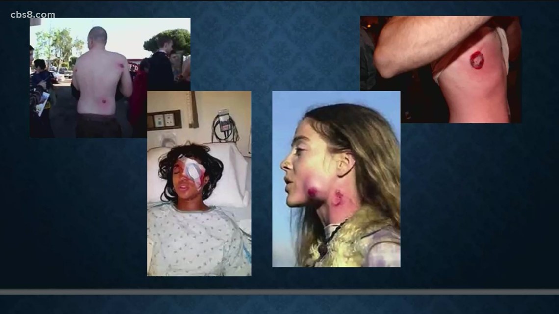 Police use of bean bag rounds and rubber bullets under scrutiny