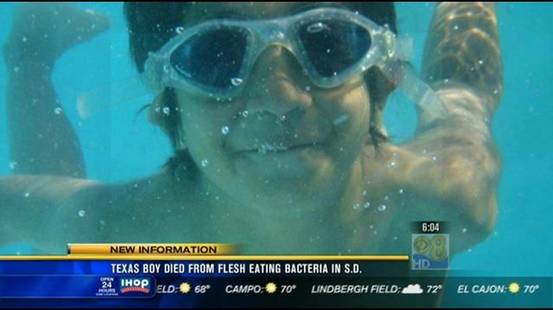 Texas boy died from flesheating bacteria in San Diego(02)