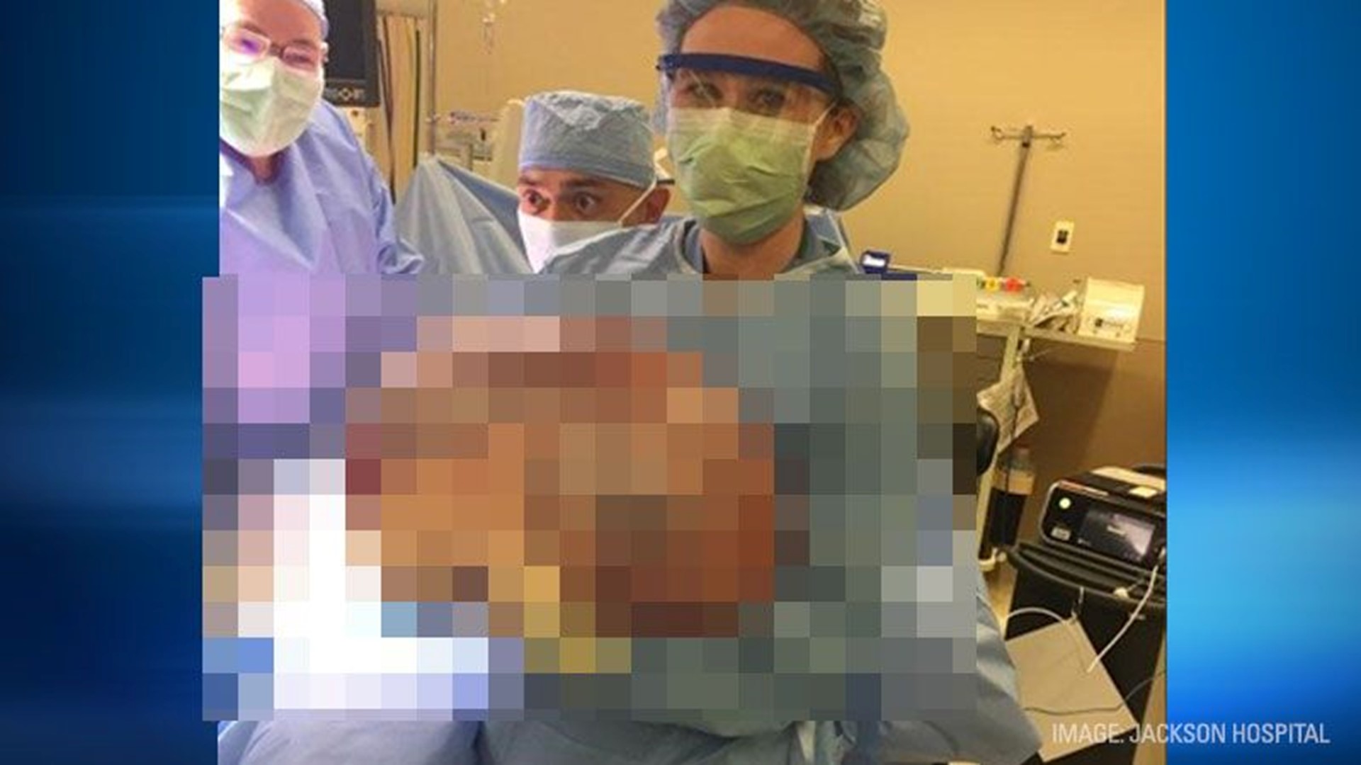 Alabama woman's unexplained weight gain turns out to be 50pound