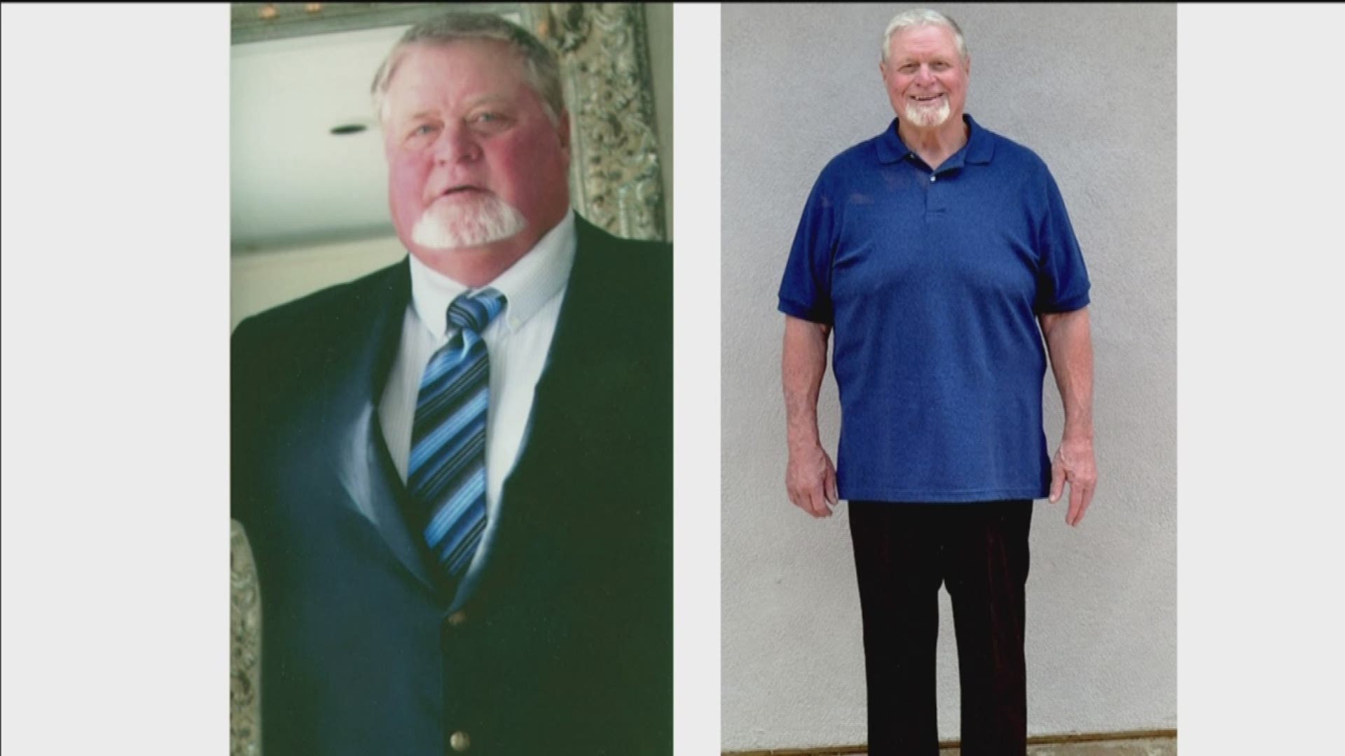 Randy Sherman of San Diego lost 144.5 pounds in one year through the non-profit TOPS (Take Off Pounds Sensibly).