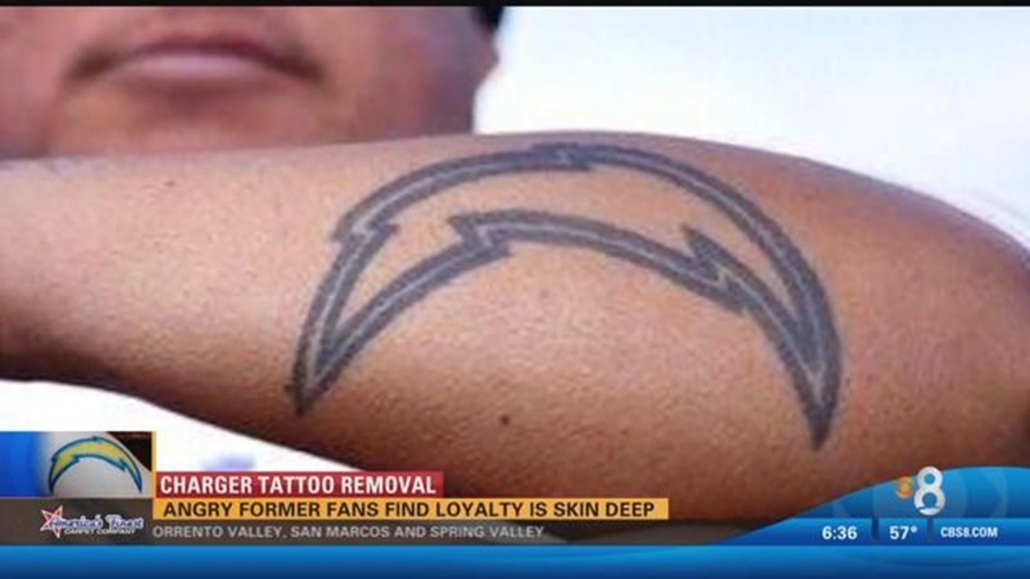San Diego Tattoo Removal Specialist  Shelley Todd