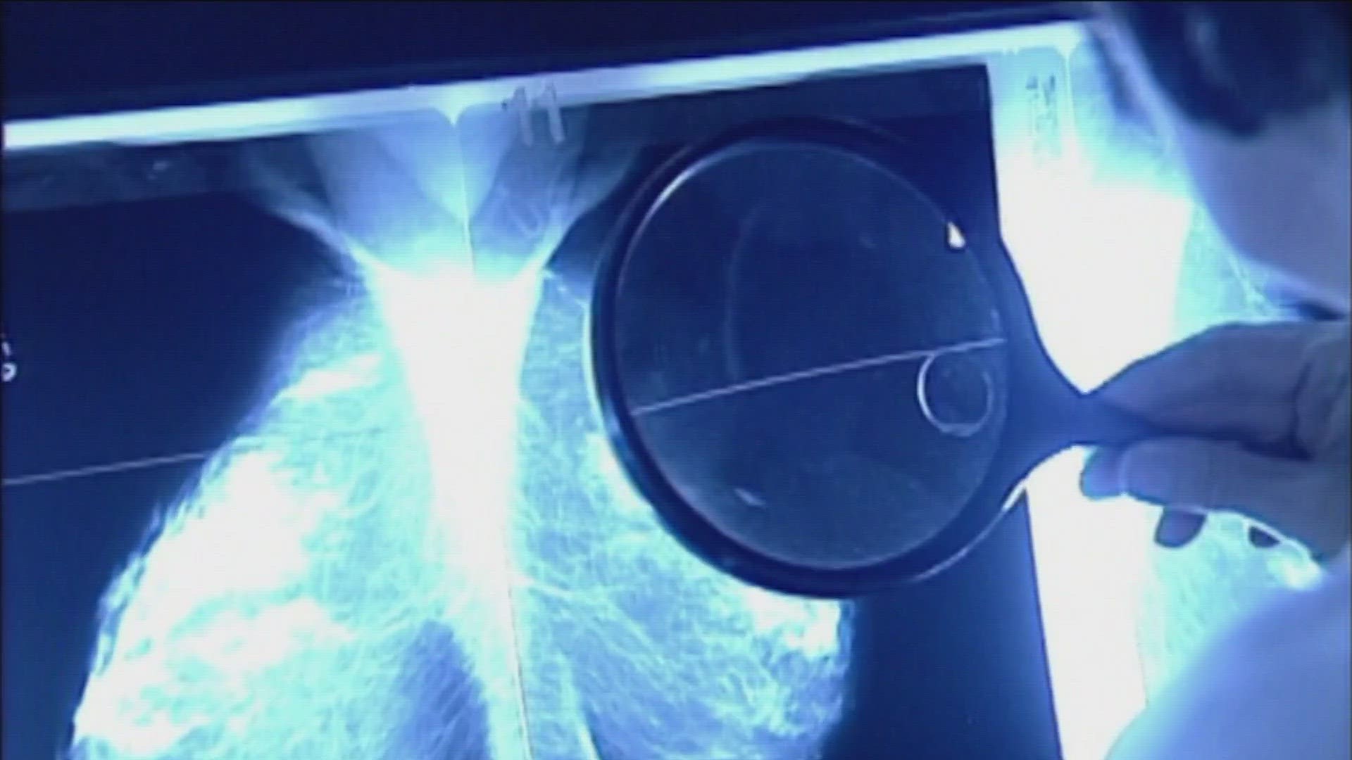 The U.S. Preventive Services Task Force has updated the recommended age for mammograms from fifty to forty.