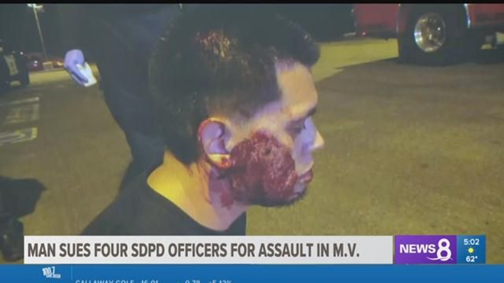 Man sues four San Diego Police officers for assault in Mission Valley