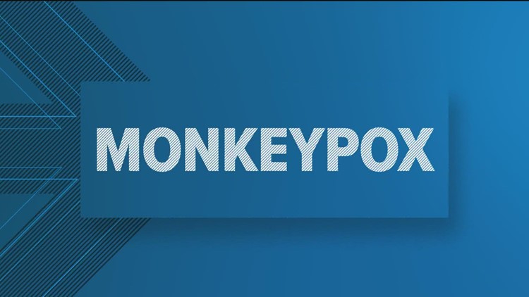Monkeypox declared public health emergency in San Diego