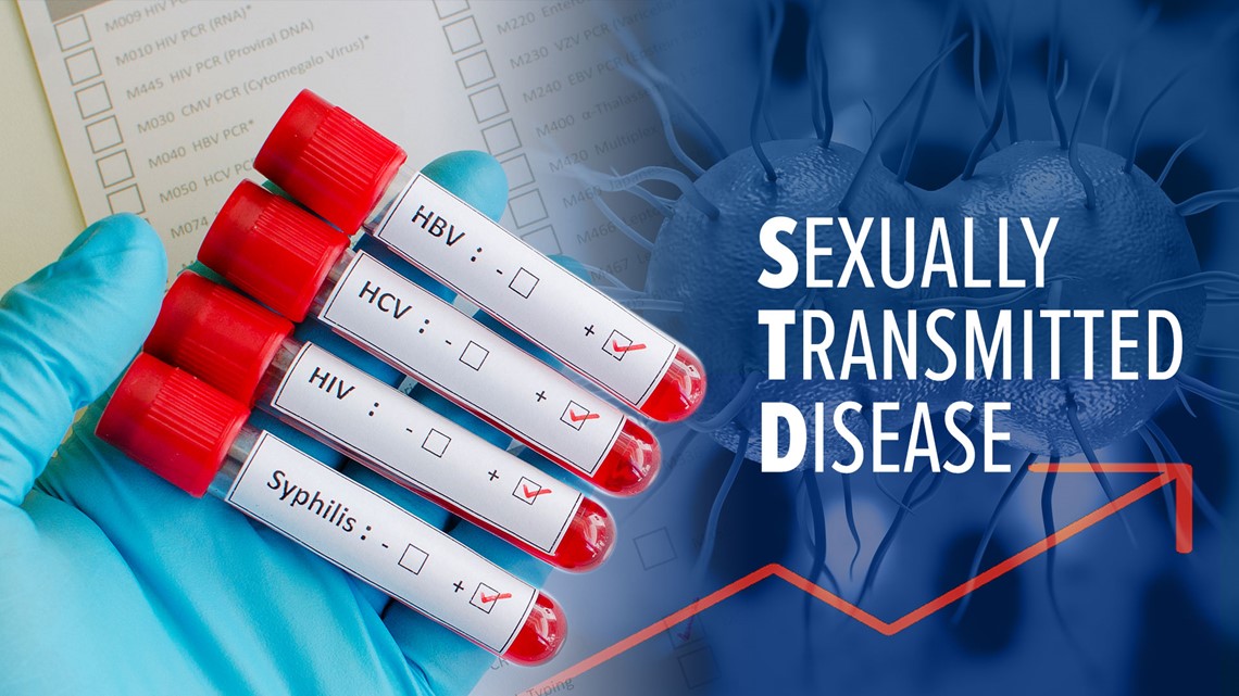 Sexually Transmitted Diseases In San Diego County Hit 20 Year High 2620