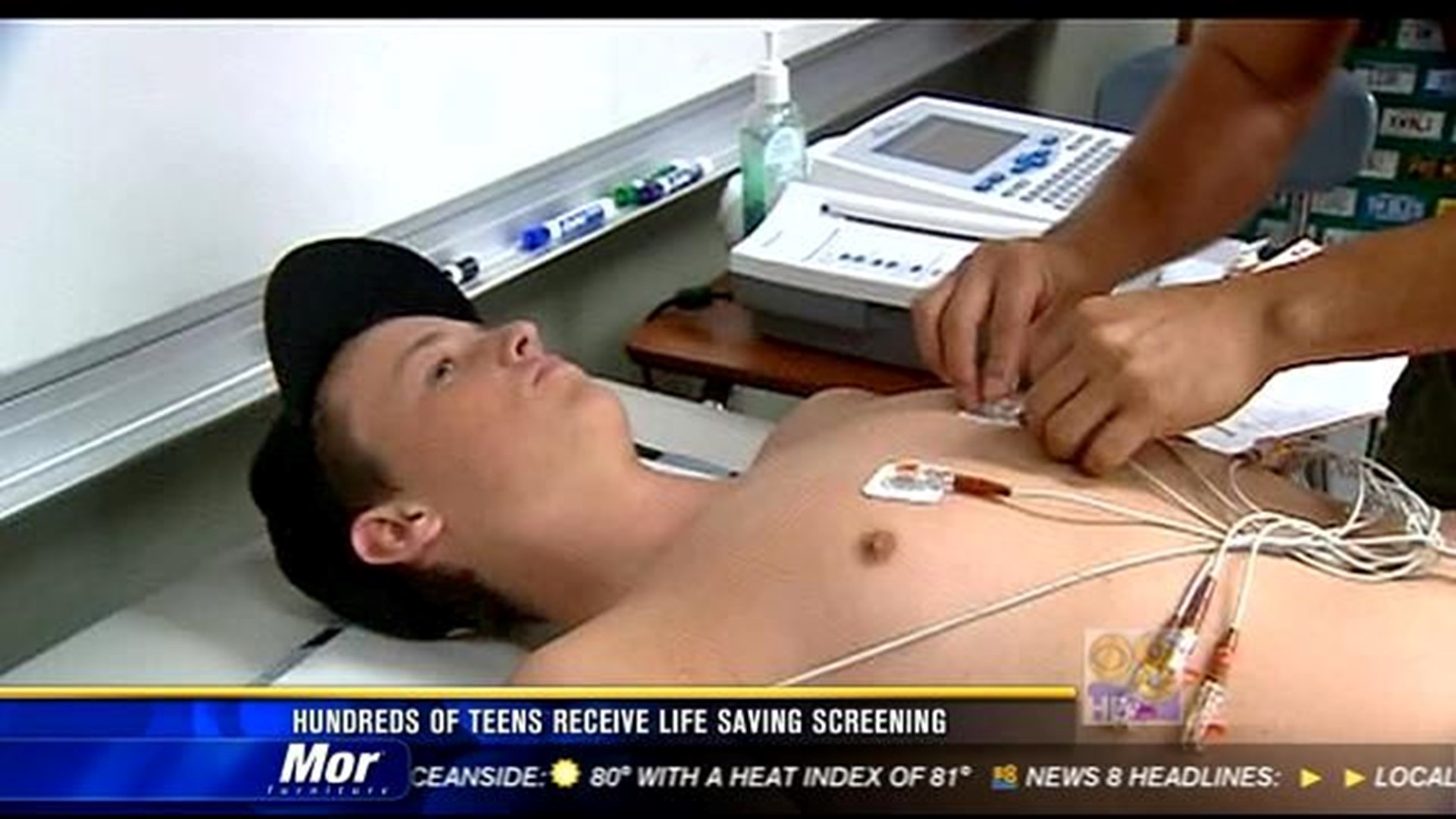 Should kids, teens have blood pressure checked? – The Mercury News