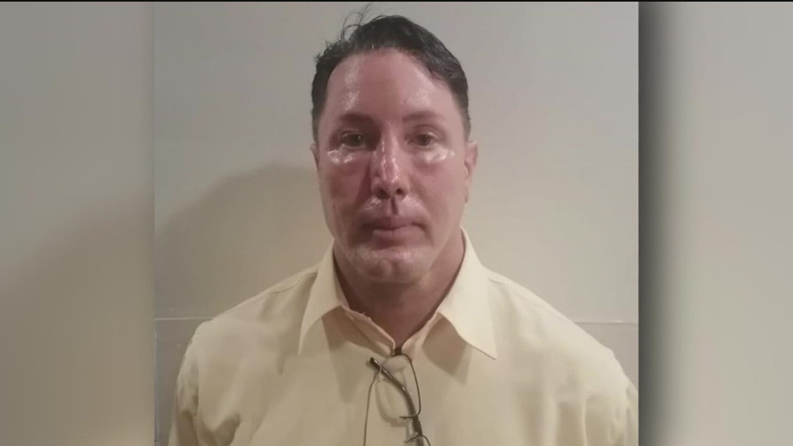 3 Dead In Long Beach Memorial Hospital Shooting | cbs8.com