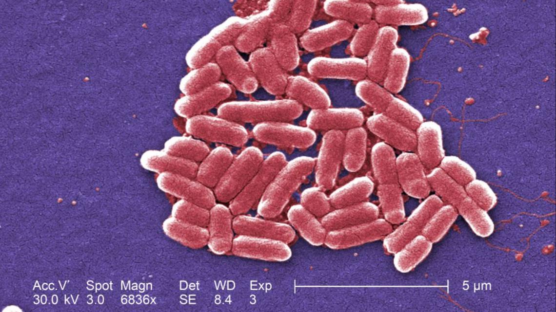 E. Coli taced back to Miguel's Cocina in 4S Ranch - Vimarsana News