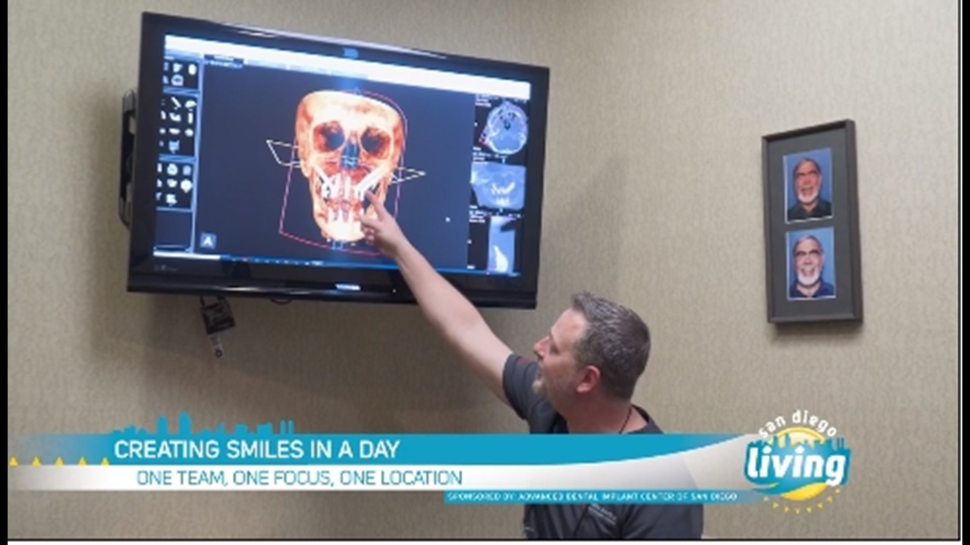 The doctors at Advanced Dental Implant Center of San Diego are providing new hope for a teeth-in-a-day solution. Sponsored by: Advanced Dental Implant Center