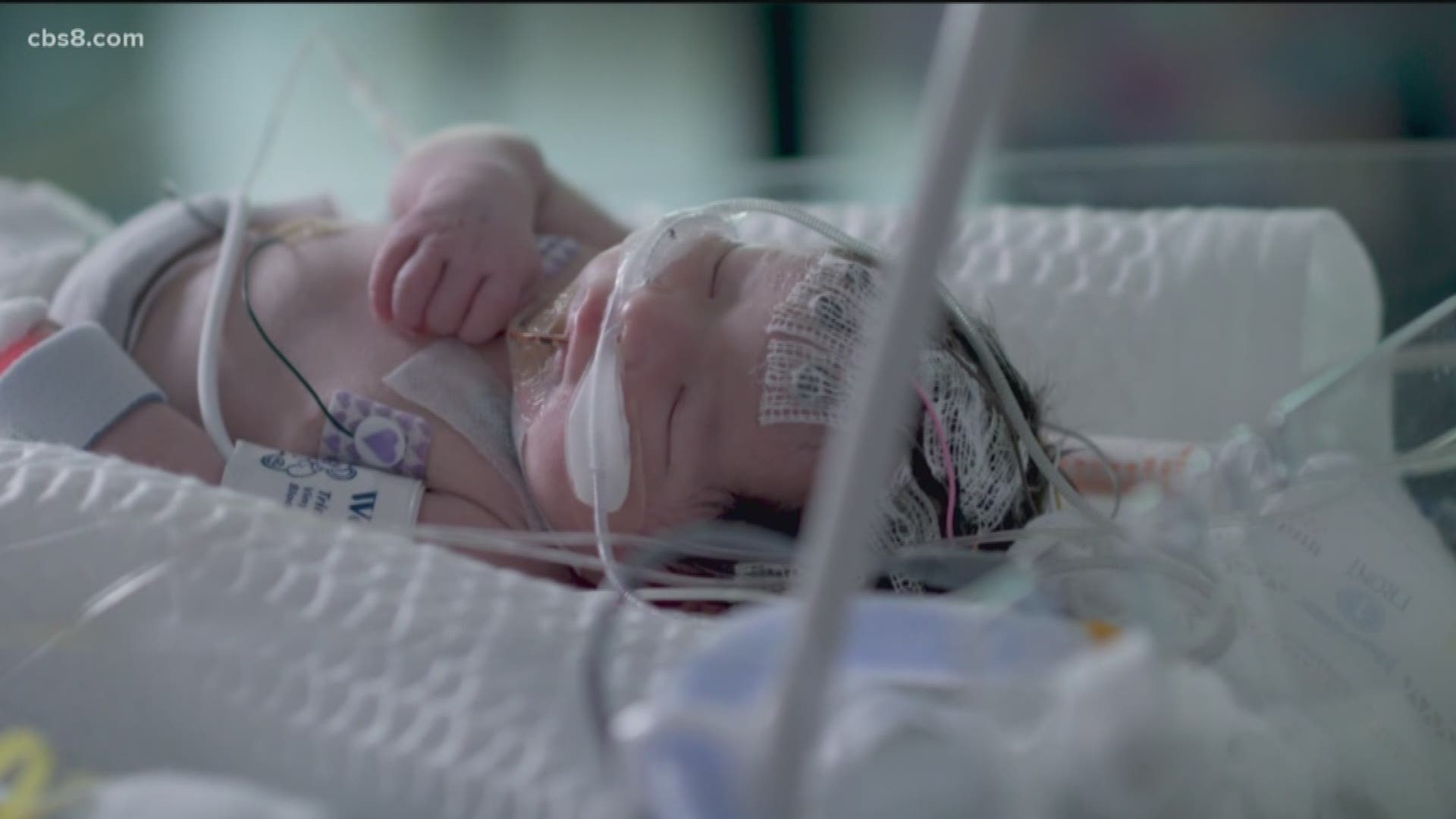 Medical innovation, developed at San Diego’s Rady Children’s Hospital is helping doctors save the lives of babies with rare genetic diseases. The new state-funded pilot program called Project Baby Bear hopes to make genomic technology available to all critically ill babies and infants who are covered by Medi-Cal.