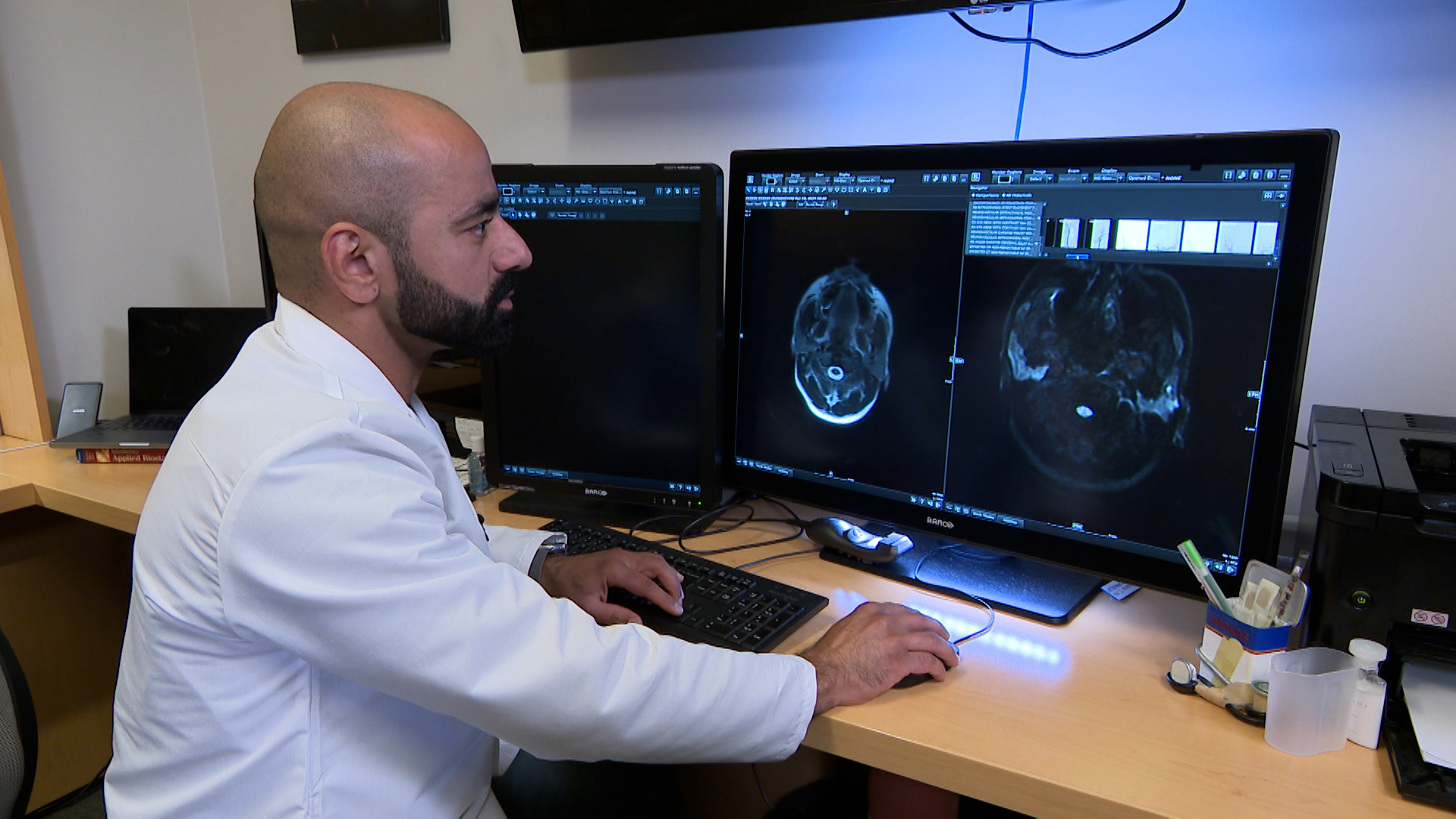 On this episode of Eye On Health, we discuss the new way hospitals are diagnosing and treating traumatic brain injuries, Billy Joel's brain condition and more.