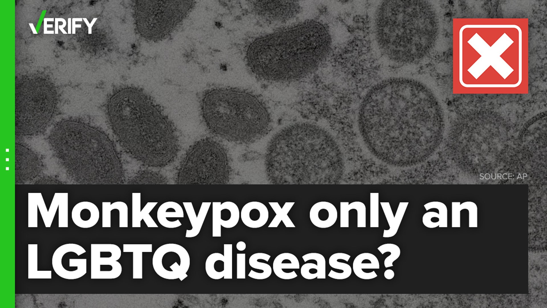 Some people on social media have falsely claimed monkeypox is a disease that is exclusive to LGBTQ people. Anyone can contract it through close contact.