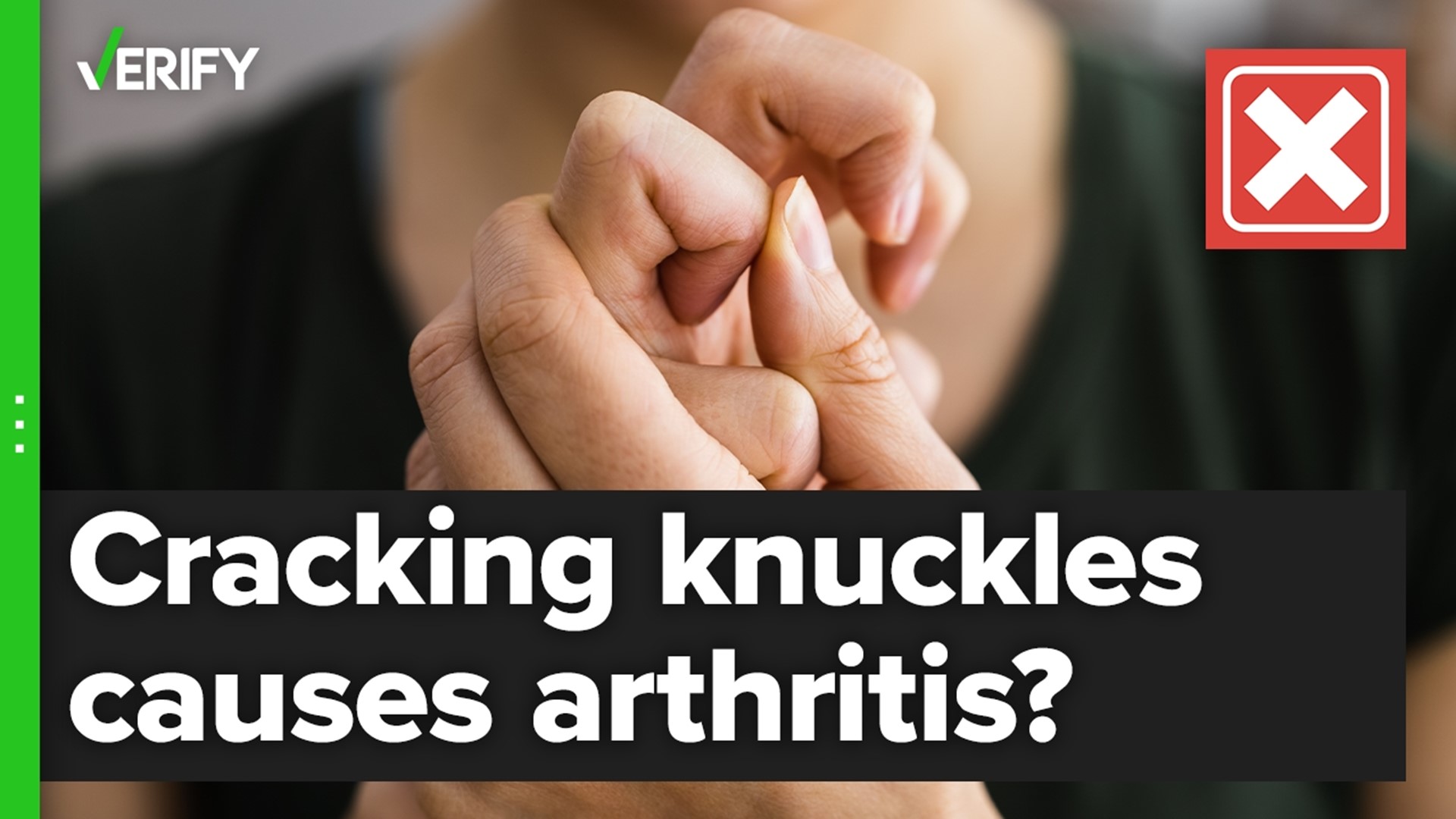 No evidence knucklecracking causes arthritis
