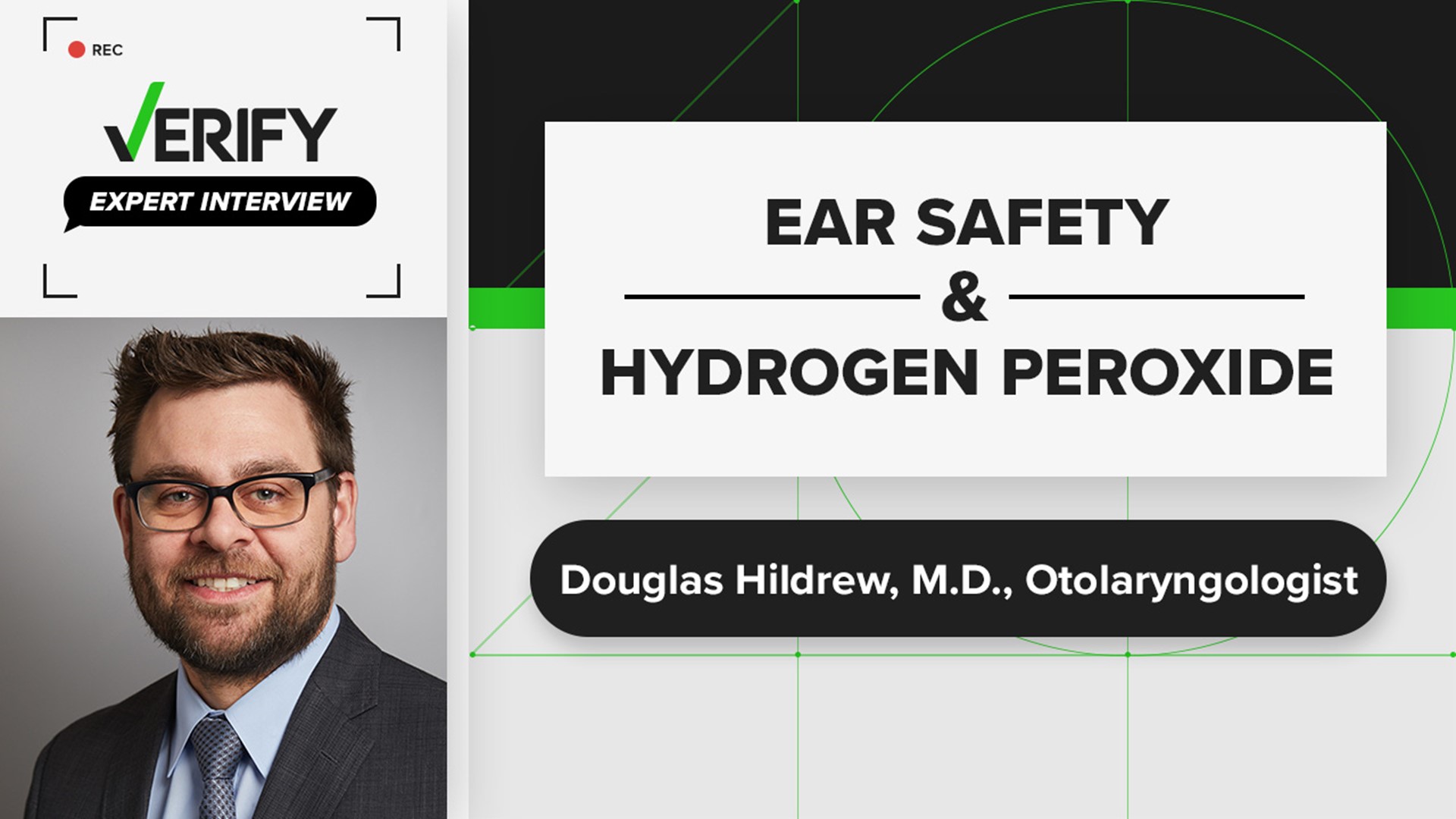 Otolaryngologist Douglas Hildrew, M.D. talks about the pros and cons of using hydrogen peroxide to clean your ears. Along with the best way to use q-tips.