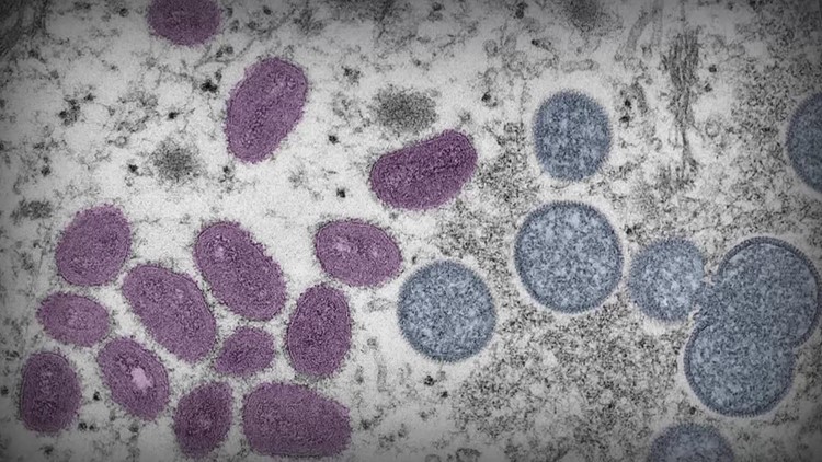 Estados Unidos declara emergencia sanitaria por el brote de viruela símica