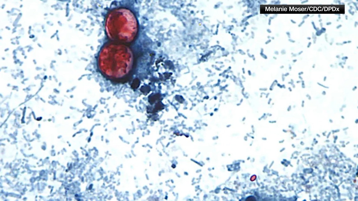 Early investigation links these foods to Michigan's cyclosporiasis outbreak